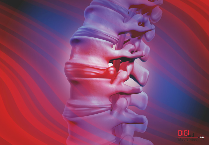 Wirbelsäule Wirbelsäule